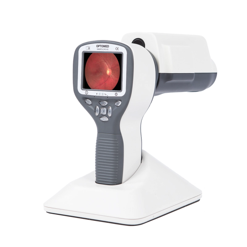 Smartscope PRO портативная фундус-камера